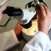 Tens of thousands of eligible Buckinghamshire women miss smear tests