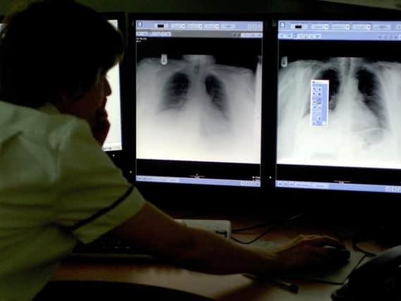 Dozens of people were diagnosed with tuberculosis in Buckinghamshire on average last year, new figures show.