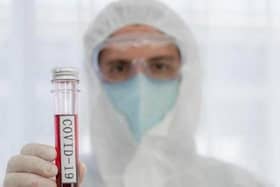 Please get yourself tested if you have symptoms of Coronavirus