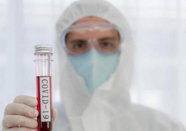 Please get yourself tested if you have symptoms of Coronavirus