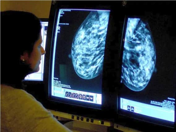 Dozens of suspected breast cancer patients waiting too long for urgent tests at Buckinghamshire Healthcare