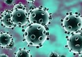 Coronavirus (Covid-19)