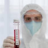 Coronavirus