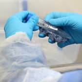 The rate of coronavirus deaths outside hospital in Aylesbury Vale has slowed, new figures suggest