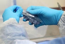 Hospital admissions increased by over 65% in the region