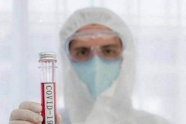 417 Covid infections were confirmed in Aylesbury Vale on January 20