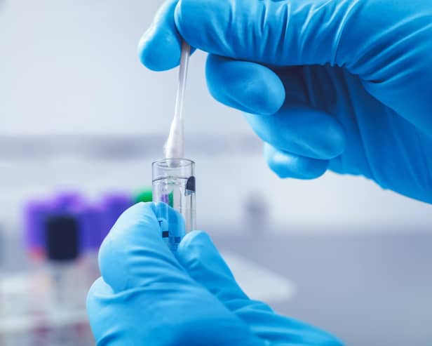 Diagnoses for gonorrhoea and syphilis hit record highs in 2022 in new findings from the UK Health Security Agency.
