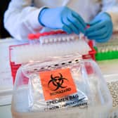 Here's where you can get tested for Coronavirus in Aylesbury this week