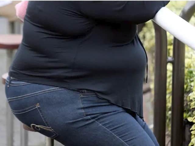 Obesity rates are increasing in Buckinghamshire