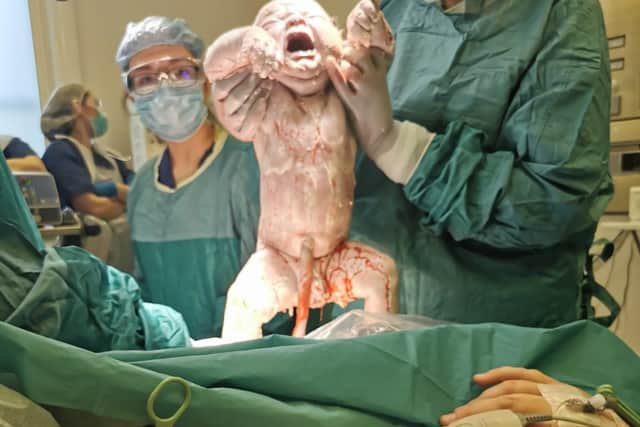 Whopper Zeik makes his entrance into the world