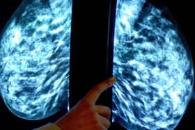 Figures show 78 per cent of eligible women in Bucks attended routine screenings between April 2019 and March 2020