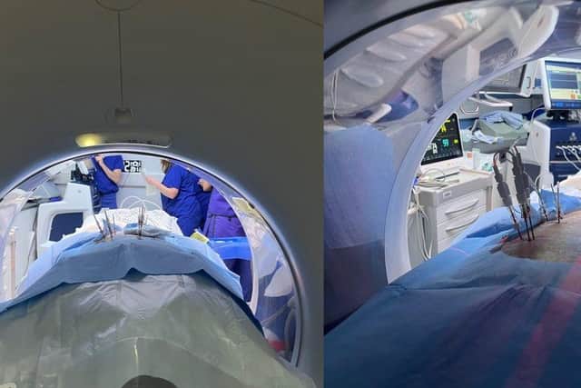 During the procedure at Stoke Mandeville Hospital