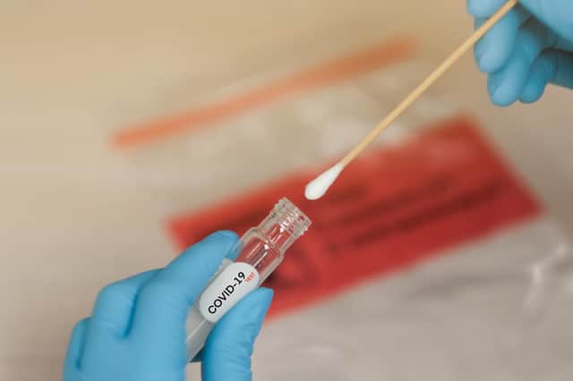 Where can I get day 2 and 8 Covid tests in my local area?