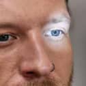 The impact diabetes can have on your eyesight