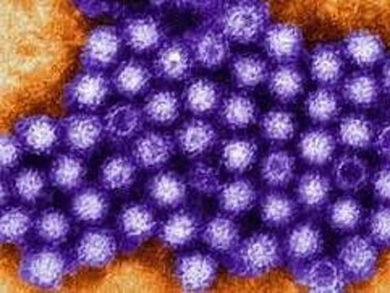 Bucks Healthcare trust have said Winter vomiting bug norovirus is "making the rounds."