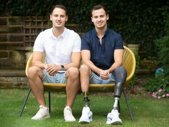 James was born prematurely at 28 weeks with his twin brother Tom, due to a condition called twin-to-twin transfusion - where one gets more blood than the other