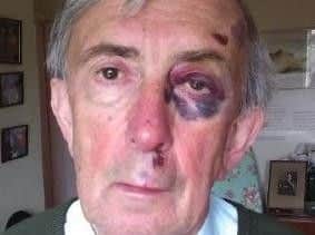 Peter Farquhar pictured after a fall - this image was shown to the court