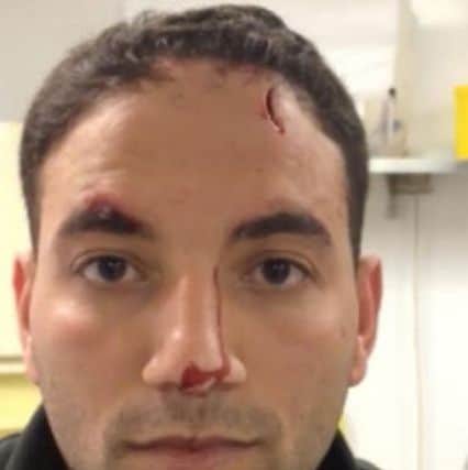 Boss of Wilsons Fish & Chips in Tring Shaban Azam was attacked with a vinegar bottle PNL-140409-180316001