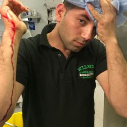 Boss of Wilsons Fish & Chips in Tring Shaban Azam was attacked with a vinegar bottle PNL-140409-180246001