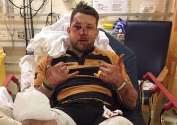 Liam Chennells is recovering after sustaining a nasty injury against Guernsey