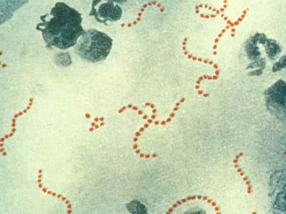 Scarlet fever