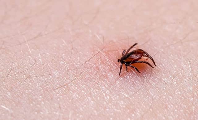 Tick bites can kill
